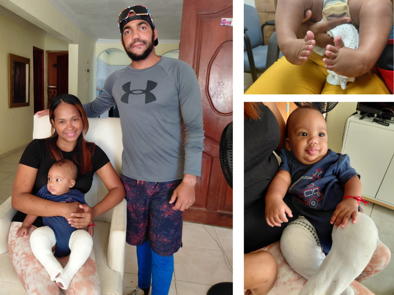 A family in the Dominican Republic holding their baby, who is wearing medical casts to treat clubfoot.